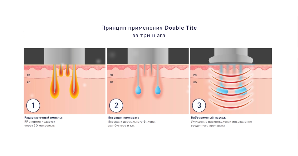 RF-лифтинг Double-Tite