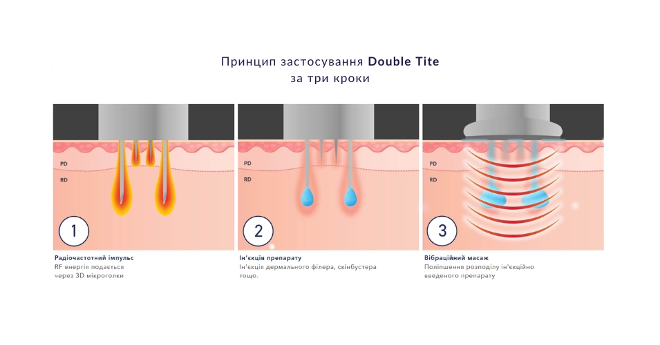 RF-ліфтинг Double-Tite