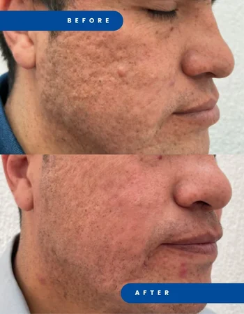 juvelook дои после 3