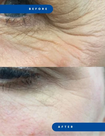 juvelook дои после 5